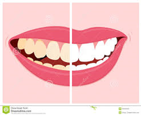 Take Home Tooth Whitening Kit 202//165